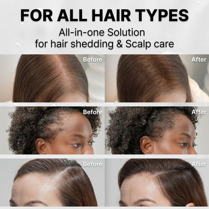 Built-in Brush Head For Massage And To Enhance Hair Density