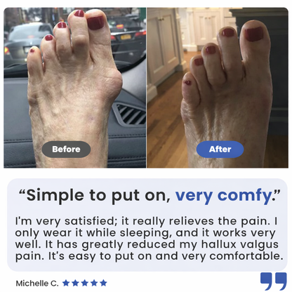 Pandora™ Bunion Fix