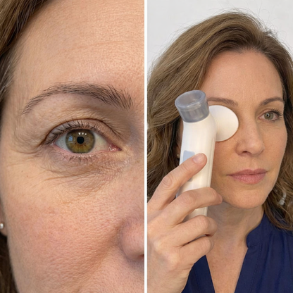 Eye Relieve Steam Therapy