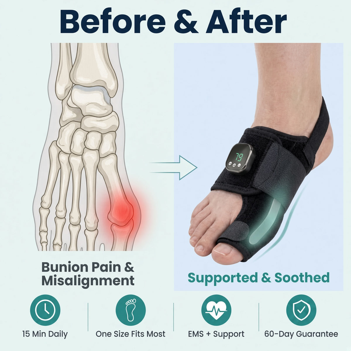 Pandora EMS Bunion Corrector