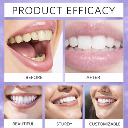 Teeth Whitening Strips